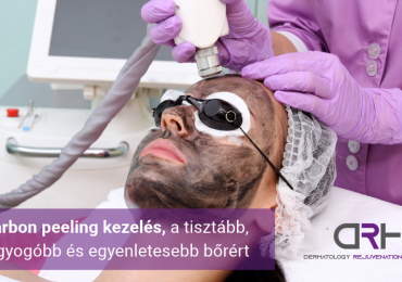 Carbon peeling kezelés