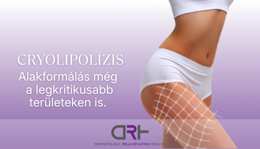 Cryolipolízis – Eredményes alakformálás még a legkritikusabb területeken is?